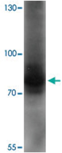 AFAP1L1, Rabbit, Polyclonal Antibody, Abnova 100 &mu;g | Buy Online | Abnova | Fisher Scientific
