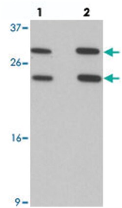 MS4A6A, Rabbit, Polyclonal Antibody, Abnova 100&mu;g; Unlabeled:Antibodies,
