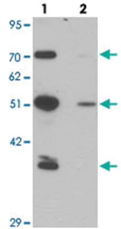 TMPO Rabbit anti-Human, Mouse, Polyclonal Antibody, Abnova 100&mu;g; Unlabeled:Antibodies,