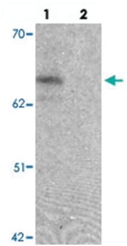 ZGPAT, Chicken, Polyclonal Antibody, Abnova 100&mu;g; Unlabeled:Antibodies,