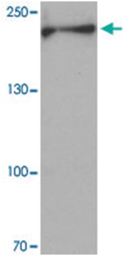 DISP1, Rabbit, Polyclonal Antibody, Abnova 100&mu;g; Unlabeled:Antibodies,