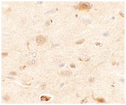 RAPGEF3, Rabbit, Polyclonal Antibody, Abnova 100&mu;g; Unlabeled:Antibodies,