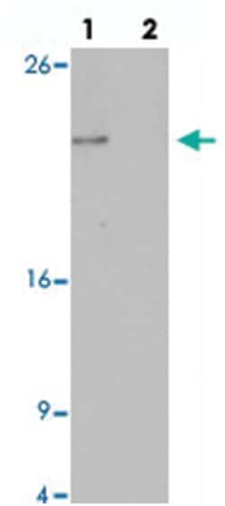 HIGD2A, Rabbit, Polyclonal Antibody, Abnova 100&mu;g; Unlabeled:Antibodies,