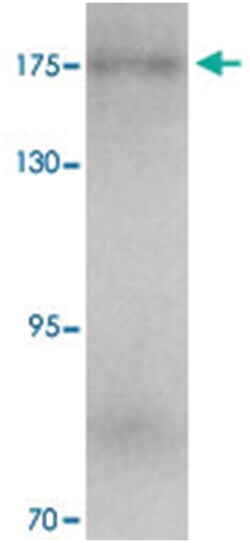 KIAA0196, Rabbit, Polyclonal Antibody, Abnova 100&mu;g; Unlabeled:Antibodies,
