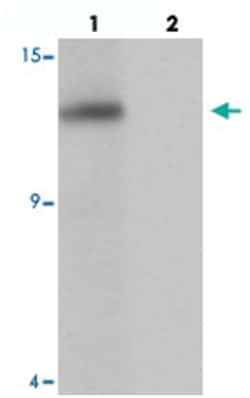 SDHAF2, Chicken, Polyclonal Antibody, Abnova 100&mu;g; Unlabeled:Antibodies,
