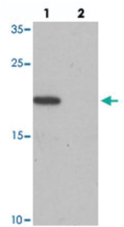LEMD1 Rabbit anti-Human, Mouse, Polyclonal Antibody, Abnova 100&mu;g; Unlabeled:Antibodies,