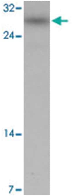 SIVA1, Chicken, Polyclonal Antibody, Abnova 100 &mu;g | Buy Online | Abnova Corporation | Fisher Scientific