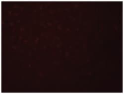 SIVA1, Chicken, Polyclonal Antibody, Abnova 100 &mu;g | Buy Online | Abnova Corporation | Fisher Scientific