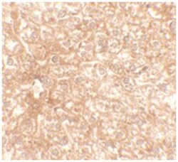 RAPGEF4, Rabbit, Polyclonal Antibody, Abnova 100&mu;g; Unlabeled:Antibodies,