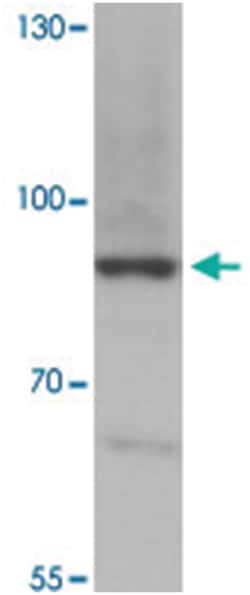 MEX3B, Rabbit, Polyclonal Antibody, Abnova 100&mu;g; Unlabeled:Antibodies,