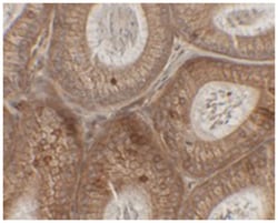 SPINK2 Rabbit anti-Human, Mouse, Polyclonal Antibody, Abnova 100 &mu;g | Buy Online | Abnova Corporation | Fisher Scientific