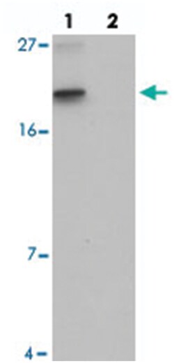 SPINK2 Rabbit anti-Human, Mouse, Polyclonal Antibody, Abnova 100 &mu;g | Buy Online | Abnova Corporation | Fisher Scientific