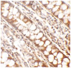 PPHLN1, Rabbit, Polyclonal Antibody, Abnova 100 &mu;g | Buy Online | Abnova Corporation | Fisher Scientific