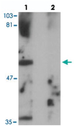 PPHLN1, Rabbit, Polyclonal Antibody, Abnova 100 &mu;g | Buy Online | Abnova Corporation | Fisher Scientific