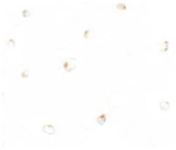 B9D1, Rabbit, Polyclonal Antibody, Abnova 100 &mu;g | Buy Online | Abnova Corporation | Fisher Scientific