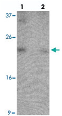 B9D1, Rabbit, Polyclonal Antibody, Abnova 100 &mu;g | Buy Online | Abnova Corporation | Fisher Scientific