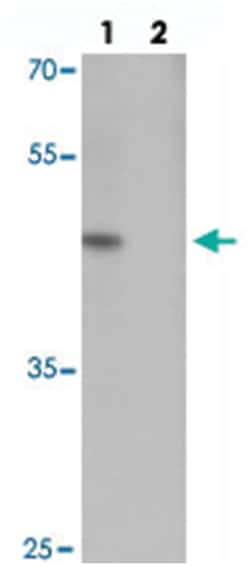 MLIP, Rabbit, Polyclonal Antibody, Abnova 100&mu;g; Unlabeled:Antibodies,