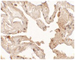 NKX2-1, Rabbit, Polyclonal Antibody, Abnova 100&mu;g; Unlabeled:Antibodies,