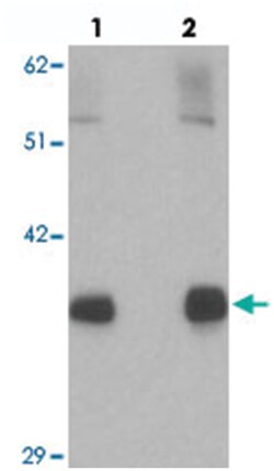 NKX2-1, Rabbit, Polyclonal Antibody, Abnova 100&mu;g; Unlabeled:Antibodies,
