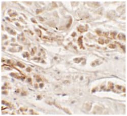 NKX2-2 Rabbit anti-Human, Mouse, Rat, Polyclonal Antibody, Abnova 100&mu;g;