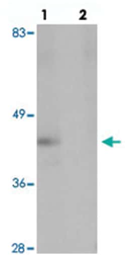 NKX2-2 Rabbit anti-Human, Mouse, Rat, Polyclonal Antibody, Abnova 100&mu;g;