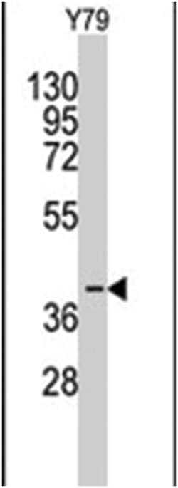 AKR1A1 Rabbit anti-Human, Polyclonal Antibody, Abnova 400 &mu;L | Buy Online | Abnova | Fisher Scientific