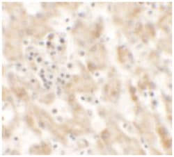 NKX2-8, Rabbit, Polyclonal Antibody, Abnova 100 &mu;g | Buy Online | Abnova | Fisher Scientific