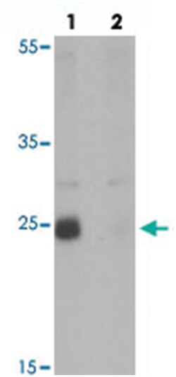 NKX2-8, Rabbit, Polyclonal Antibody, Abnova 100 &mu;g | Buy Online | Abnova | Fisher Scientific