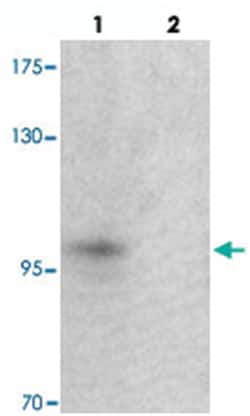TSHZ2 Rabbit anti-Human, Mouse, Rat, Polyclonal Antibody, Abnova 100&mu;g;