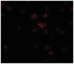 TSHZ2 Rabbit anti-Human, Mouse, Rat, Polyclonal Antibody, Abnova 100&mu;g;