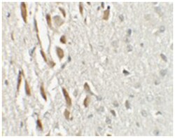 TSHZ3 Rabbit anti-Human, Mouse, Rat, Polyclonal Antibody, Abnova 100 &mu;g | Buy Online | Abnova Corporation | Fisher Scientific