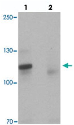TSHZ3 Rabbit anti-Human, Mouse, Rat, Polyclonal Antibody, Abnova 100 &mu;g | Buy Online | Abnova Corporation | Fisher Scientific