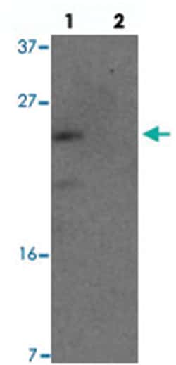YPEL1, Rabbit, Polyclonal Antibody, Abnova 100 &mu;g | Buy Online | Abnova Corporation | Fisher Scientific