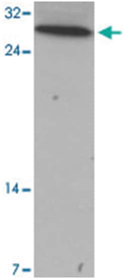 YPEL2, Rabbit, Polyclonal Antibody, Abnova 100 &mu;g | Buy Online | Abnova Corporation | Fisher Scientific