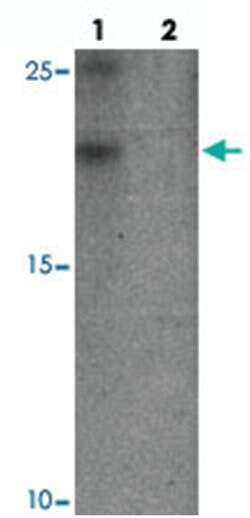 YPEL3 Rabbit anti-Human, Mouse, Rat, Polyclonal Antibody, Abnova 100 &mu;g | Buy Online | Abnova Corporation | Fisher Scientific