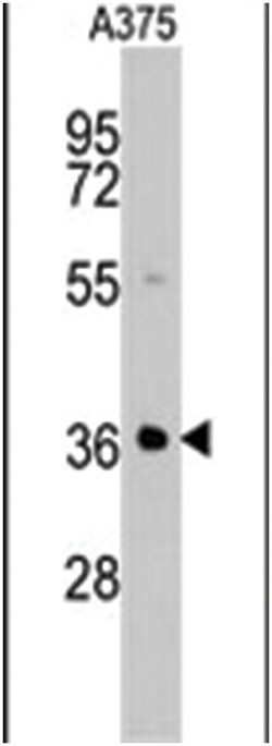 AKR1B1 Rabbit anti-Human, Polyclonal Antibody, Abnova 400 &mu;L | Buy Online | Abnova Corporation | Fisher Scientific