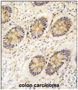 AKR1B1 Rabbit anti-Human, Polyclonal Antibody, Abnova 400 &mu;L | Buy Online | Abnova Corporation | Fisher Scientific
