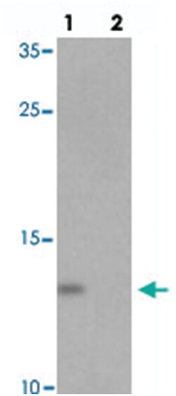 YPEL5, Rabbit, Polyclonal Antibody, Abnova 100&mu;g; Unlabeled:Antibodies,