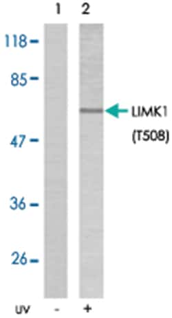 LIMK1 (phospho T508), Rabbit anti-Human, Mouse, Rat, Polyclonal Antibody,