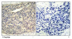 LIMK1 (phospho T508), Rabbit anti-Human, Mouse, Rat, Polyclonal Antibody,