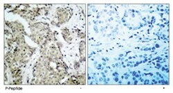 MAP2K6 (phospho S207), Rabbit anti-Human, Rat, Polyclonal Antibody, Abnova