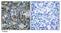 VASP (phospho S238), Rabbit anti-Human, Mouse, Polyclonal Antibody, Abnova