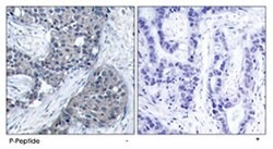 EIF4E (phospho S209), Rabbit anti-Human, Mouse, Rat, Polyclonal Antibody,