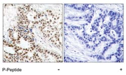 BRCA1 (phospho S1423), Rabbit anti-Human, Polyclonal Antibody, Abnova 100 &mu;g | Buy Online | Abnova Corporation | Fisher Scientific