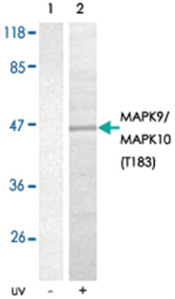 MAPK9/MAPK10 (phospho T183), Rabbit anti-Human, Mouse, Rat, Polyclonal