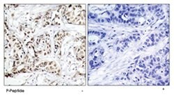 MAPK9/MAPK10 (phospho T183), Rabbit anti-Human, Mouse, Rat, Polyclonal