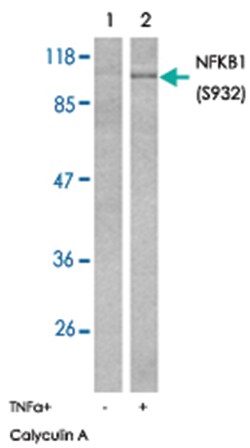 NFKB1 (phospho S932), Rabbit anti-Human, Mouse, Rat, Polyclonal Antibody, Abnova 100 &mu;g | Buy Online | Abnova Corporation | Fisher Scientific