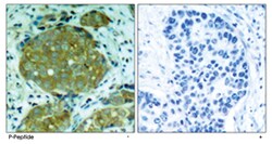 NFKB1 (phospho S932), Rabbit anti-Human, Mouse, Rat, Polyclonal Antibody, Abnova 100 &mu;g | Buy Online | Abnova Corporation | Fisher Scientific