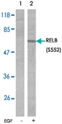 RELB (phospho S552), Rabbit anti-Human, Mouse, Polyclonal Antibody, Abnova 100 &mu;g | Buy Online | Abnova Corporation | Fisher Scientific