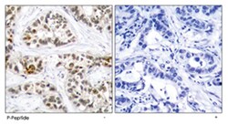 RELB (phospho S552), Rabbit anti-Human, Mouse, Polyclonal Antibody, Abnova 100 &mu;g | Buy Online | Abnova Corporation | Fisher Scientific